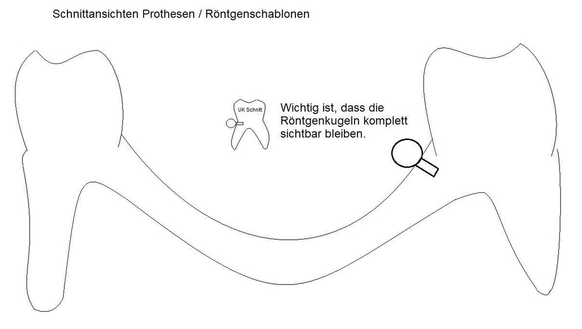 Röntgenkugeln aus bariumsulfathaltigem Kunststoff für CT, DVT (7)