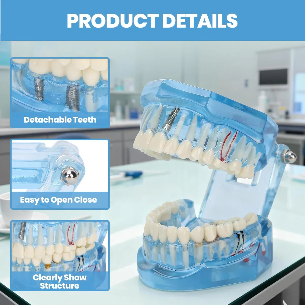 Zahnärztliches Oral-Typodont-Modell, Acryl-Blau-Zahnmodelle, Transparentes Mundmodell, Zahnmodell, Kompatibel Für Zahnmedizinisches Studium, Lehre, Forschung