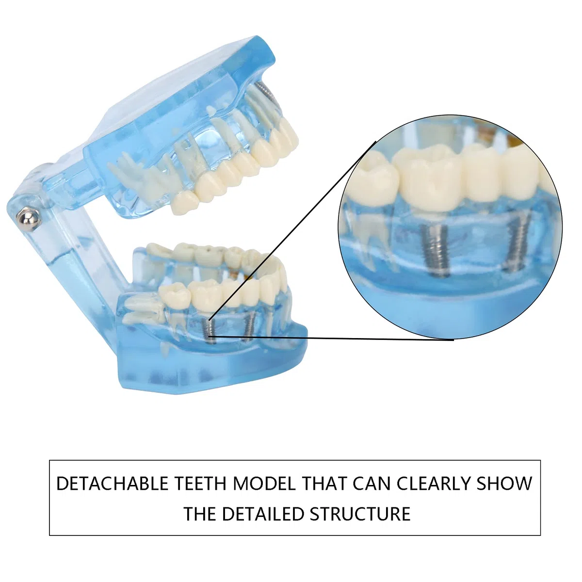 Zahnärztliches Oral-Typodont-Modell, Acryl-Blau-Zahnmodelle, Transparentes Mundmodell, Zahnmodell, Kompatibel Für Zahnmedizinisches Studium, Lehre, Forschung