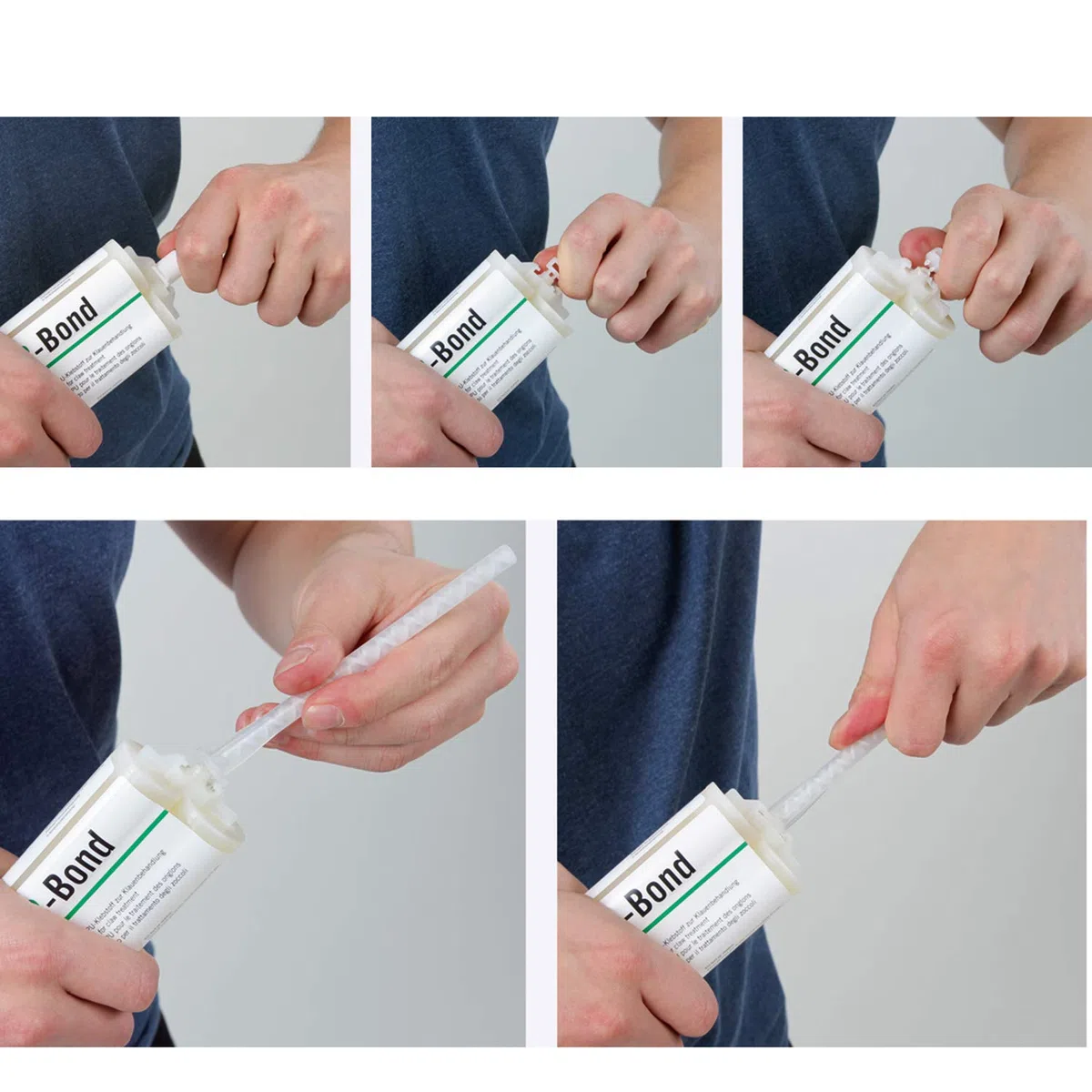Technovit-2-Bond Kartusche, 160ml