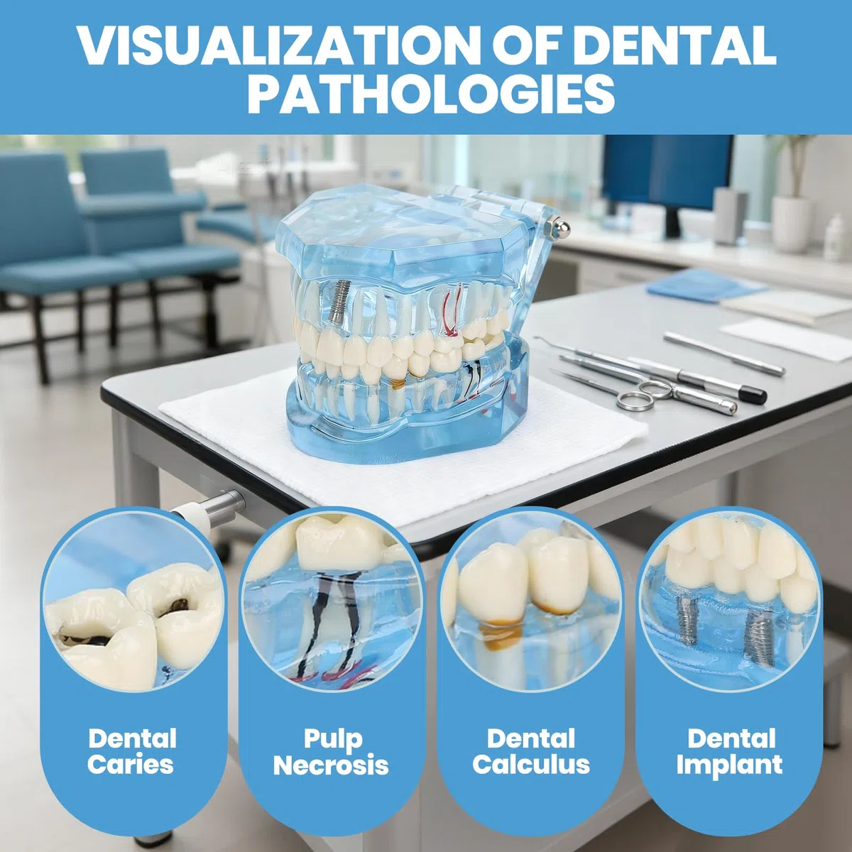 Zahnärztliches Oral-Typodont-Modell, Acryl-Blau-Zahnmodelle, Transparentes Mundmodell, Zahnmodell, Kompatibel Für Zahnmedizinisches Studium, Lehre, Forschung
